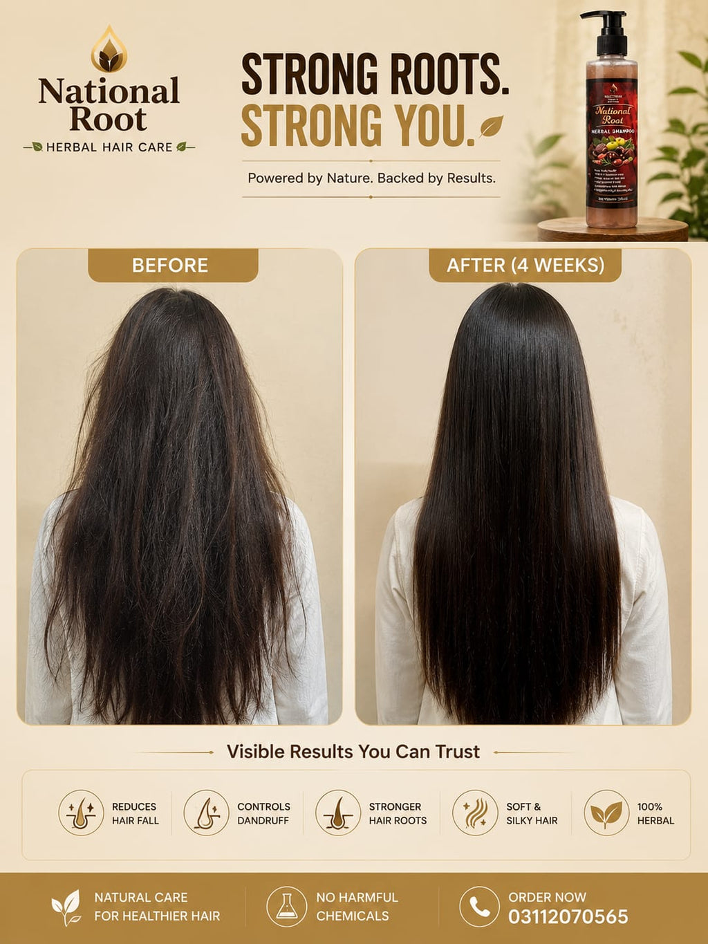 National Root Herbal Shampoo 200ml | Hair Fall Control | Anti Dandruff